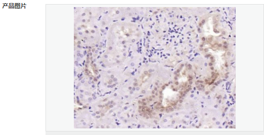 6052aa359a66c.png image.png