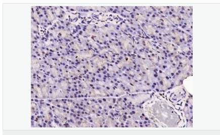 60544df8e298a.png image.png