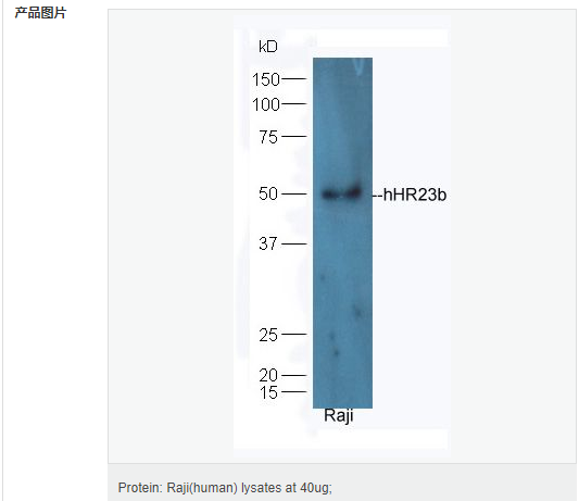 605956a160cb9.png image.png