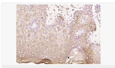 6065799ff13de.png image.png